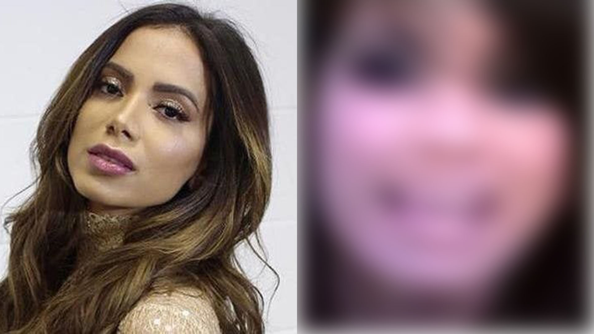 Anitta resgata vídeo antigo de Natal e diferença no visual impressiona