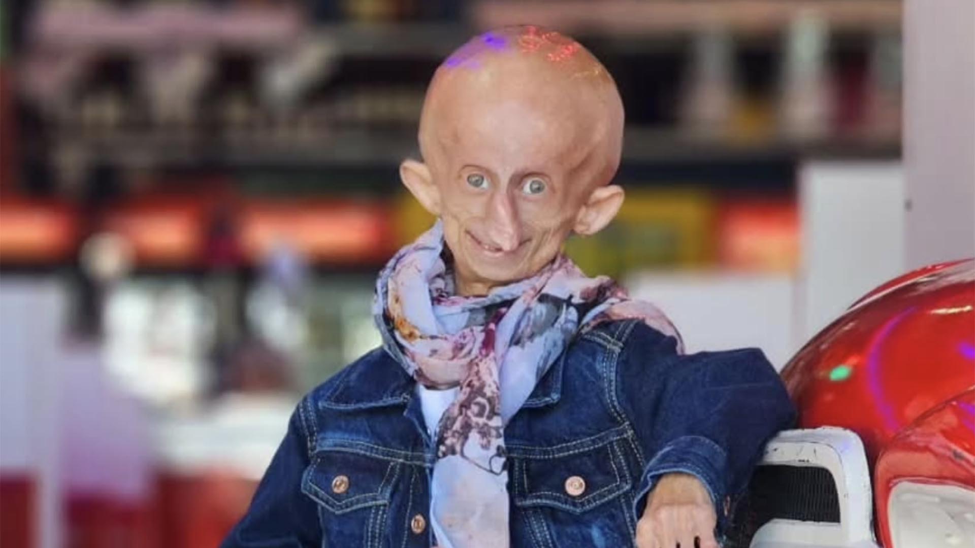Estrela do TikTok, Beandri Booysen morre aos 19 anos. Entenda a doença dela