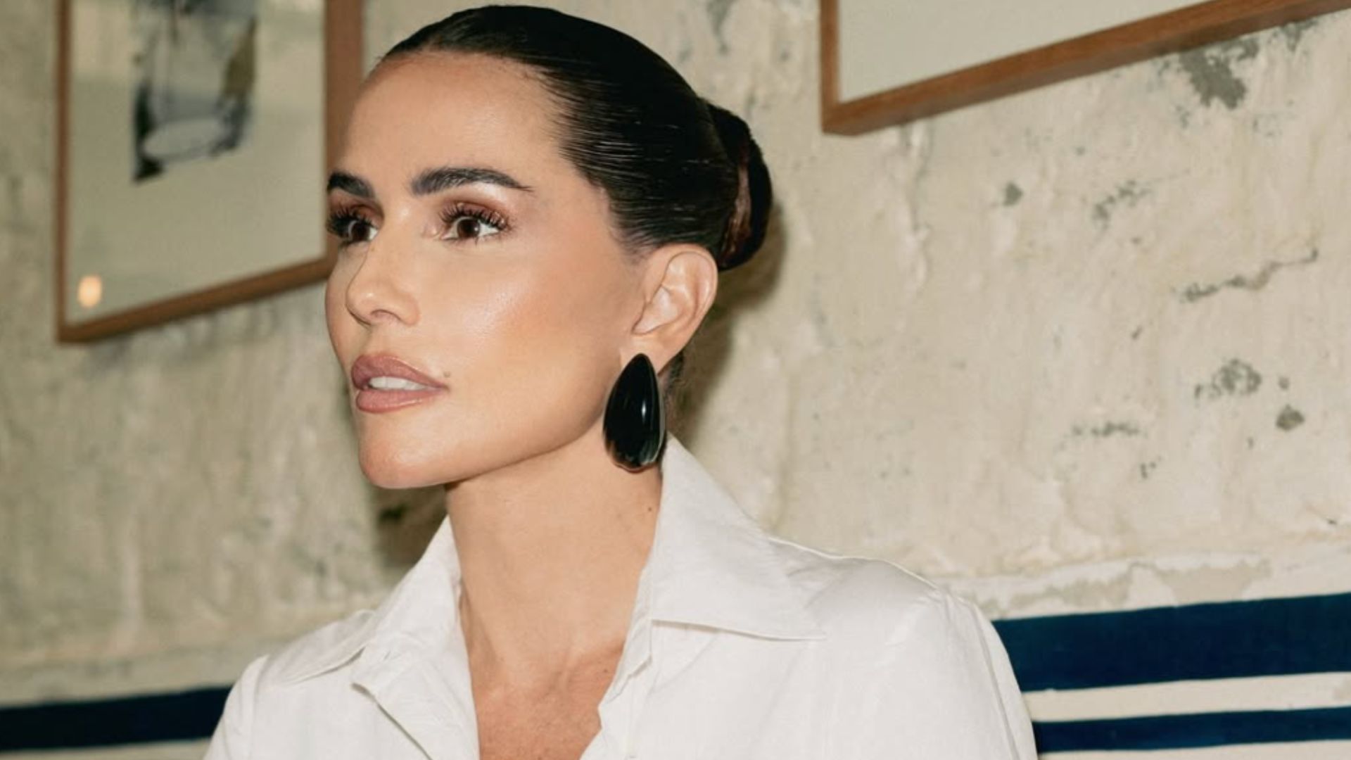Especialista detalha transplante de sobrancelha feito por Deborah Secco