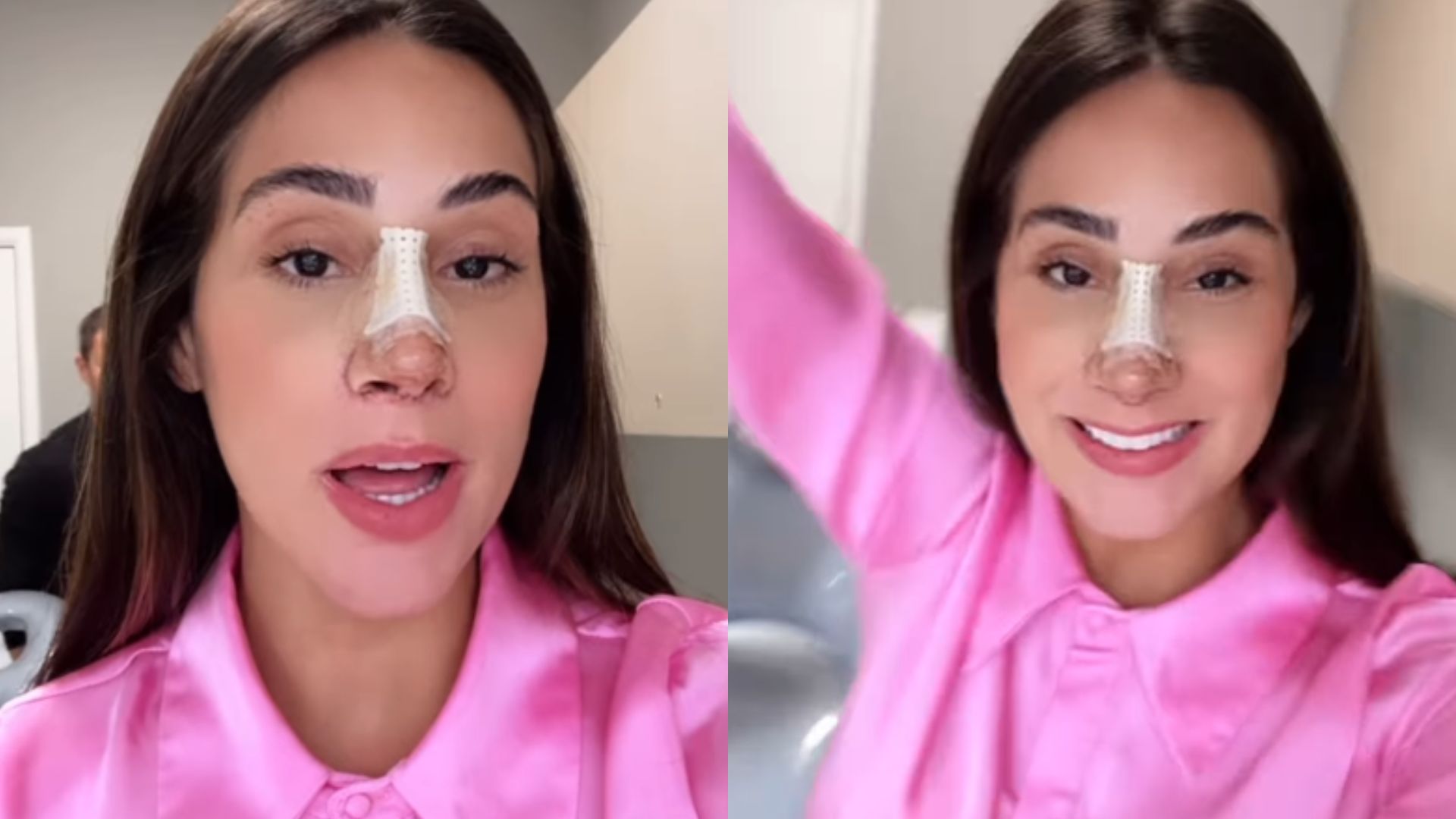 Ex-BBB Deniziane exibe resultado de cirurgia plástica: ‘Estou encantada’