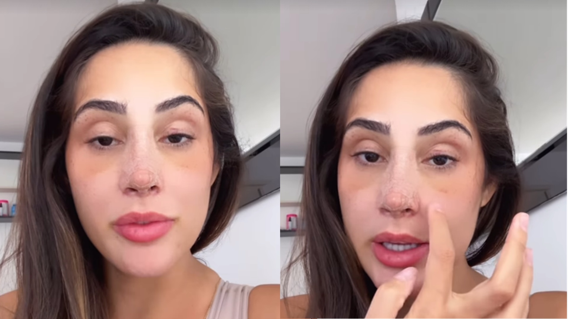 Ex-BBB Deniziane comenta sobre recuperação após cirurgia: ‘Aos poucos’