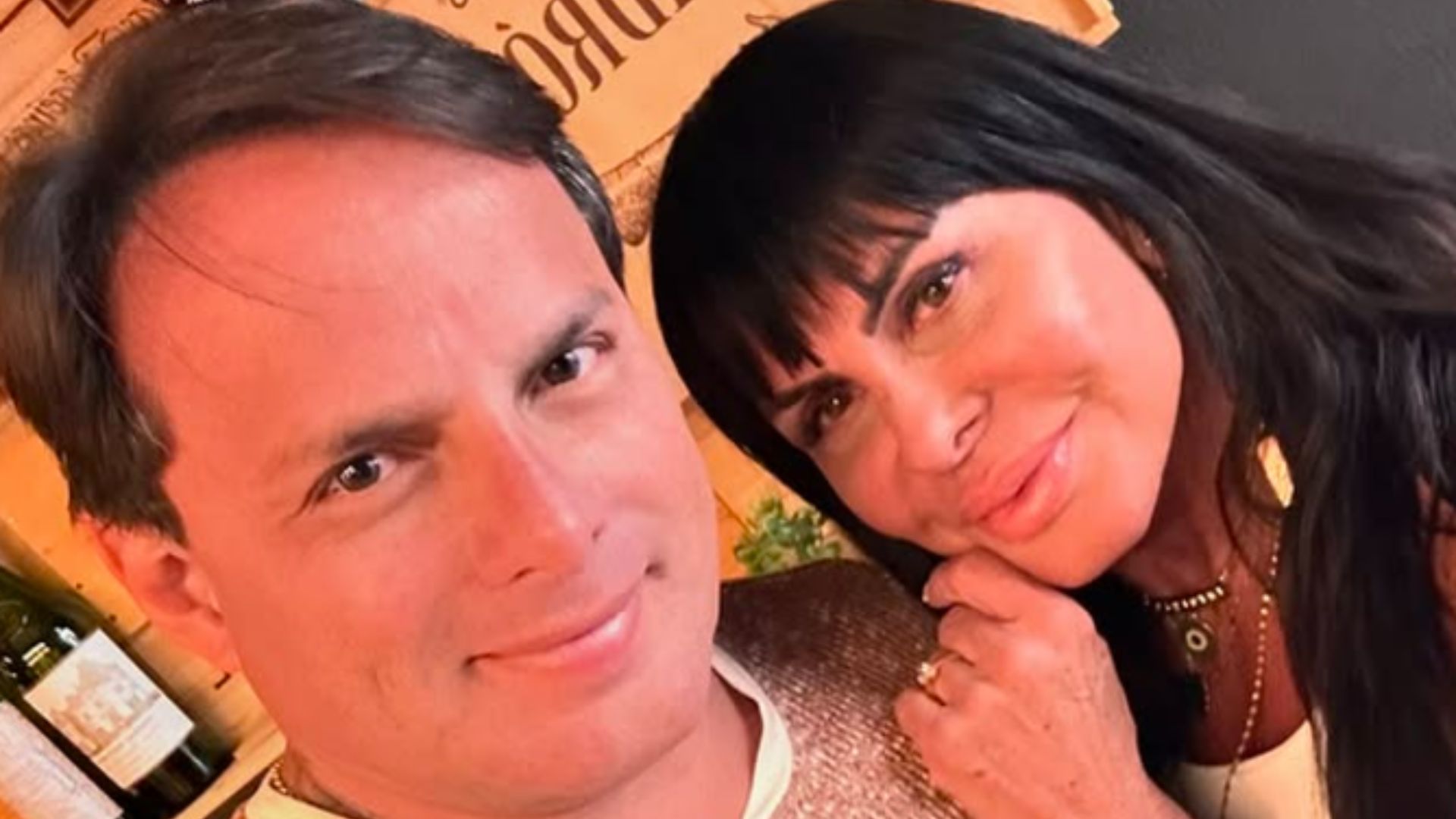 Marido de Gretchen choca internautas ao exibir antes e depois de procedimentos no rosto