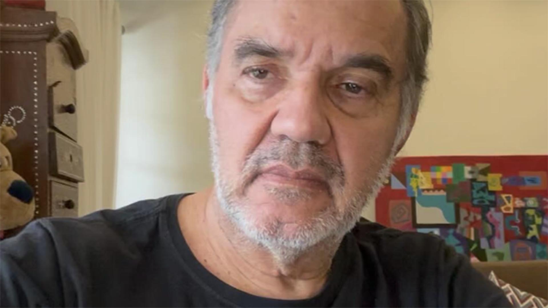 Humberto Martins faz harmonização facial. Veja o resultado