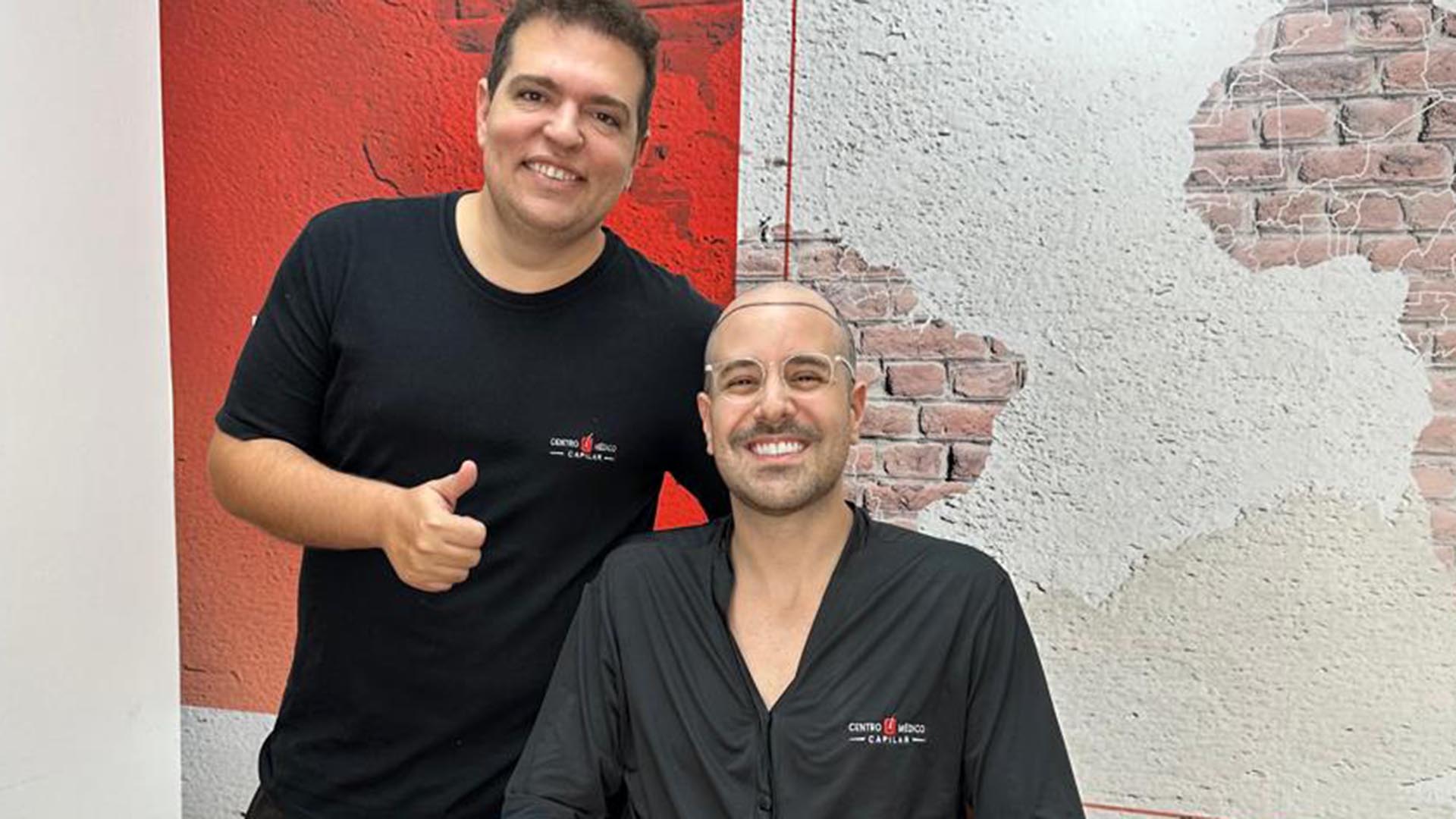 Paulo Mathias faz transplante capilar e médico explica: ‘Grau 5 de calvície’