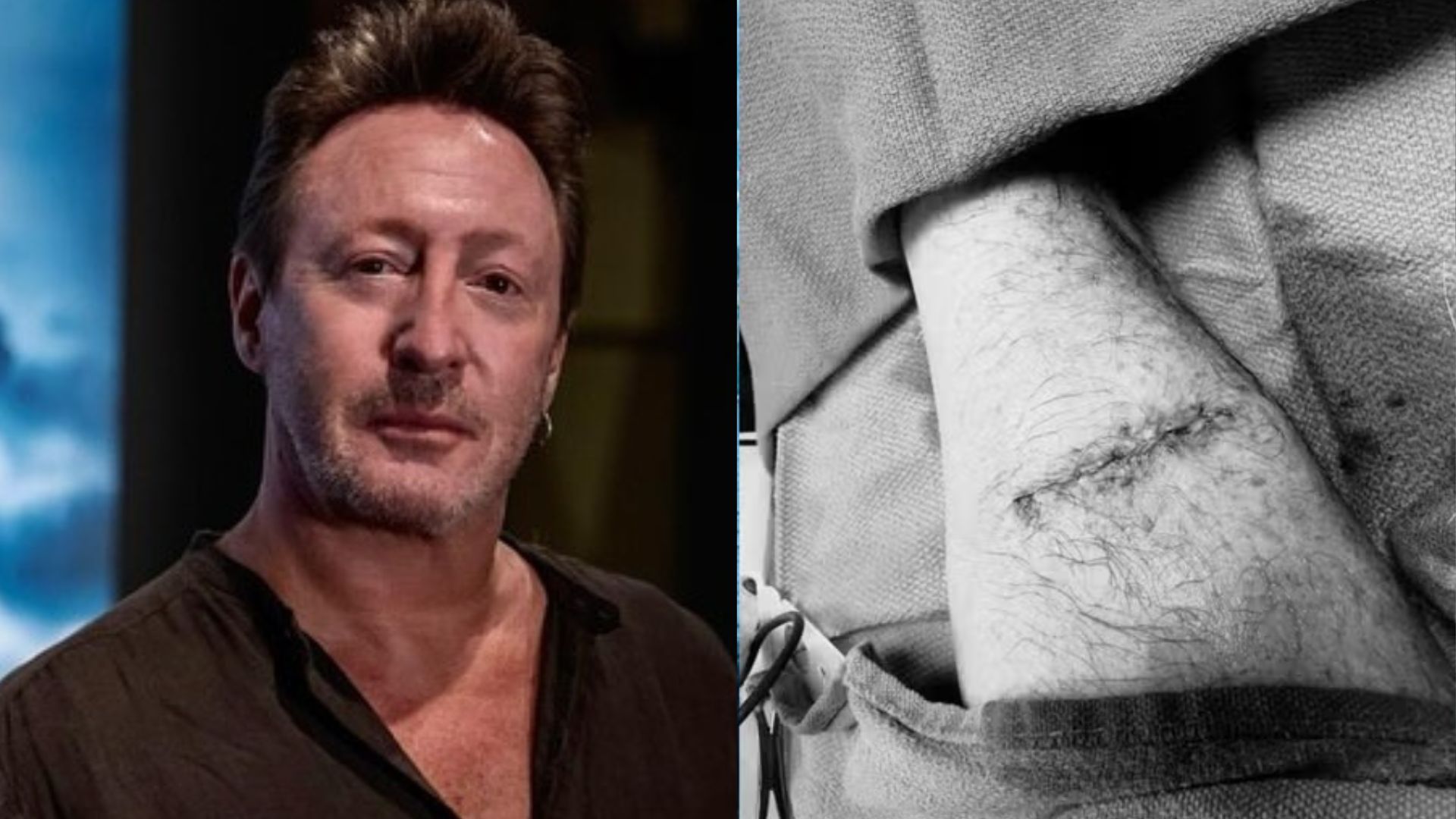 Filho de John Lennon é diagnosticado com câncer e passa por cirurgia
