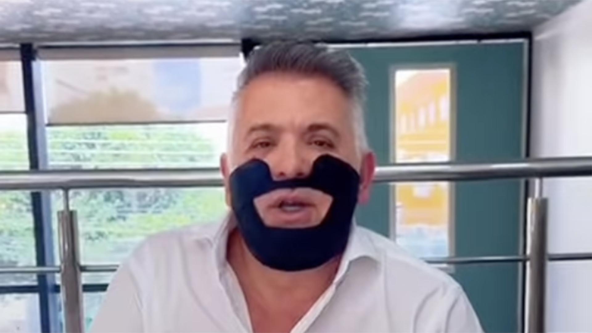 Marido de Gloria Pires remove curativo do rosto após cirurgia e mostra foto