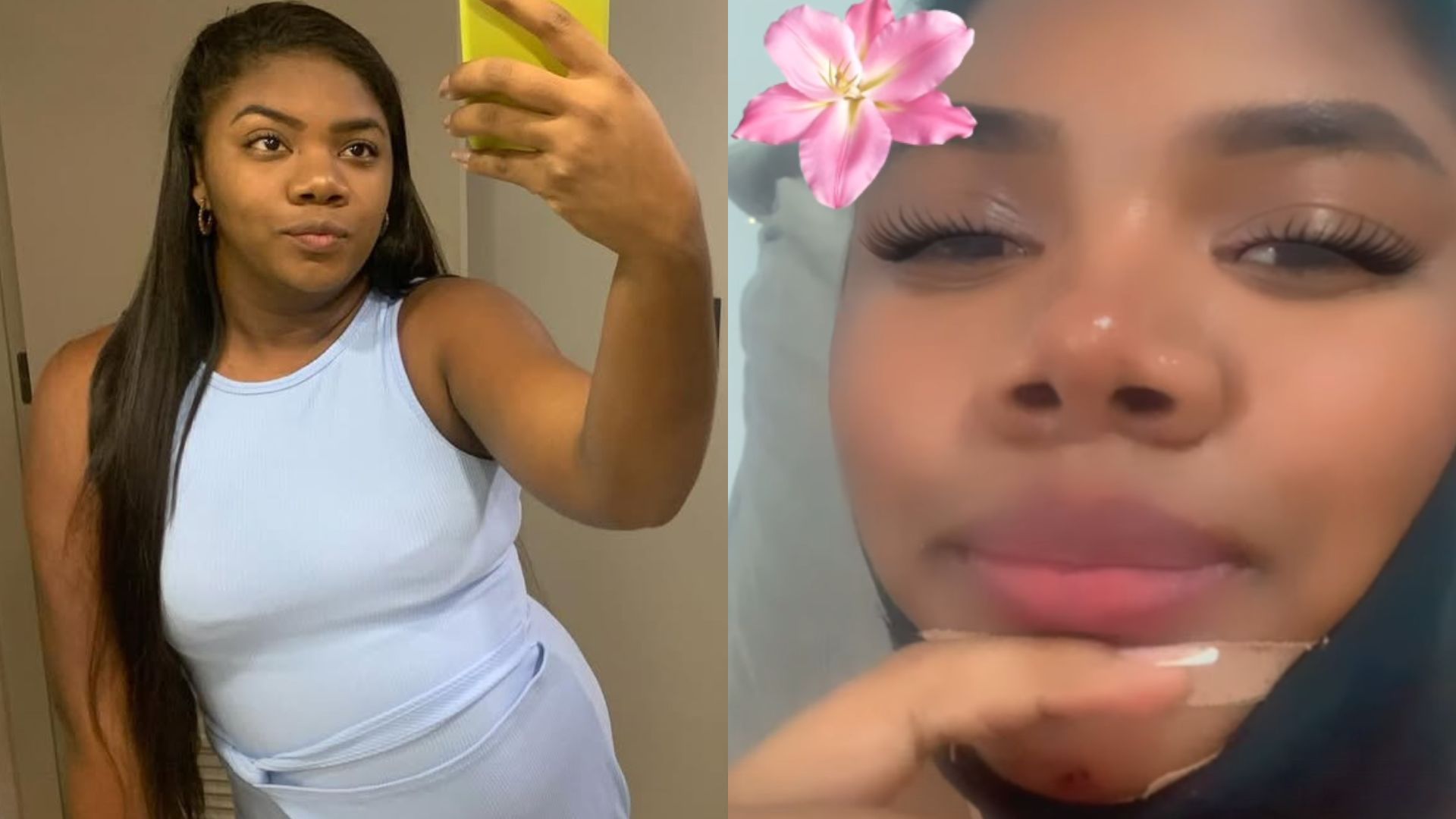 Raquel Brito explica motivo para ter feito cirurgia plástica: ‘Muito importante’