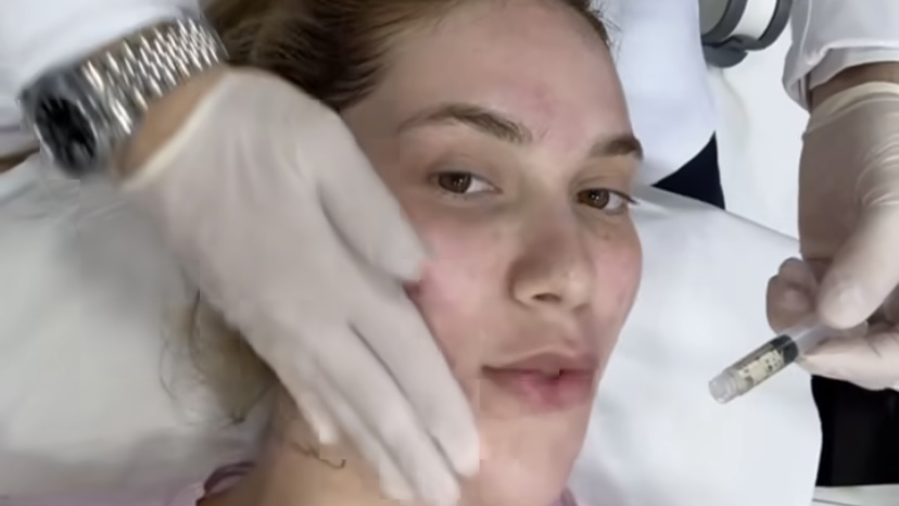 Virginia Fonseca surpreende ao revelar tratamento facial com esperma de salmão