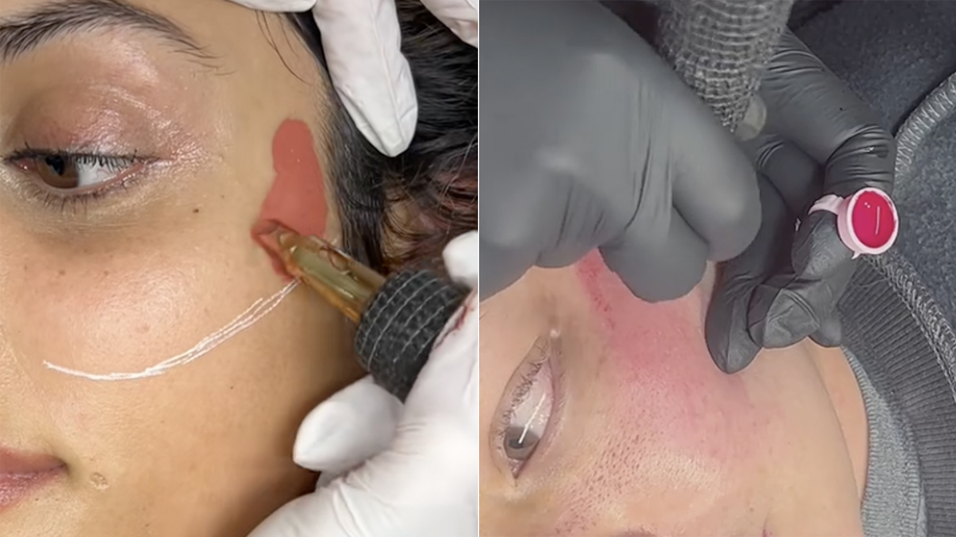 Blush Permanente é perigoso? Médica explica os riscos da trend do Tiktok
