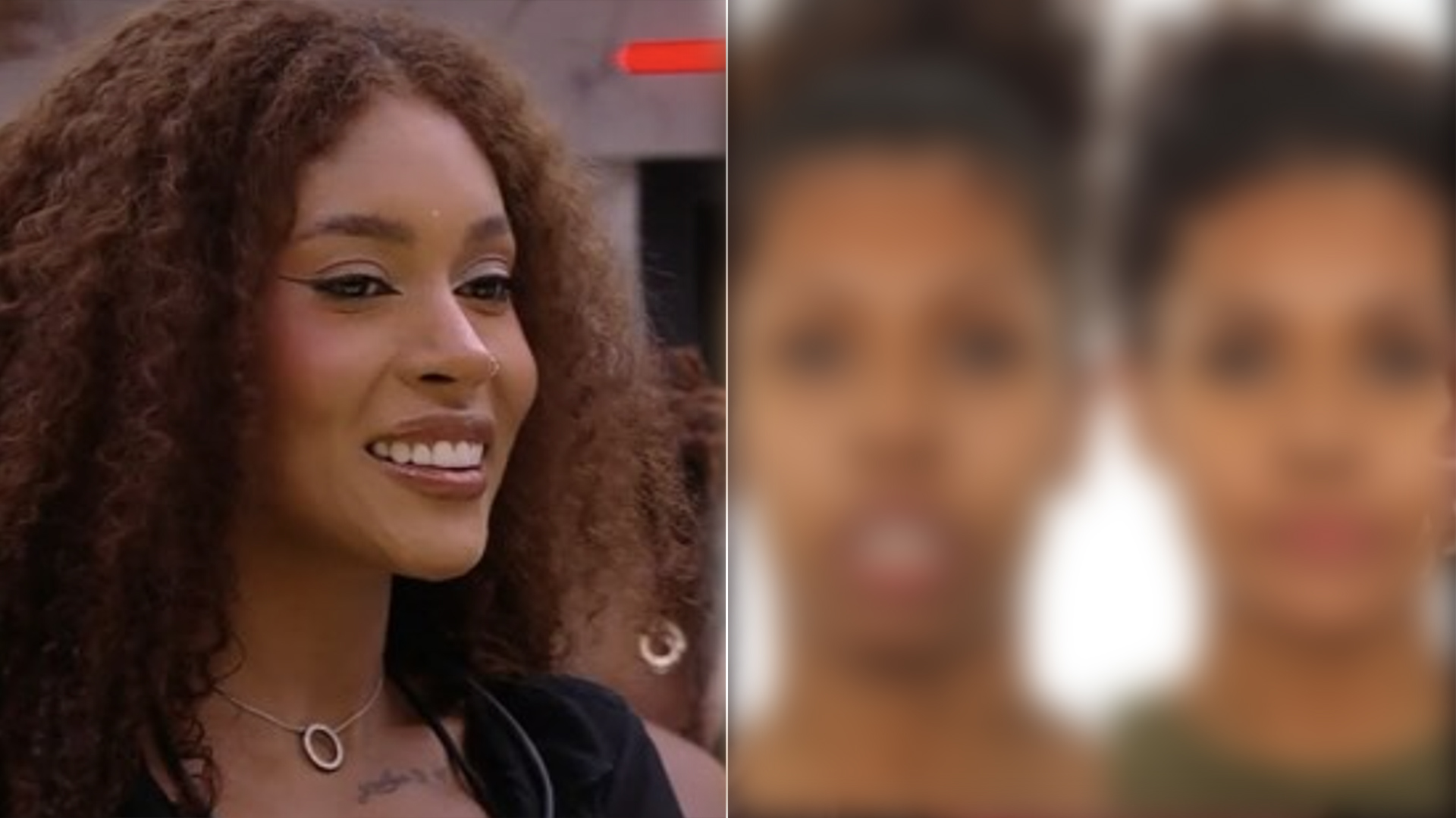 Médica de Giovanna, do BBB 25, revela o que foi feito no rosto da jovem