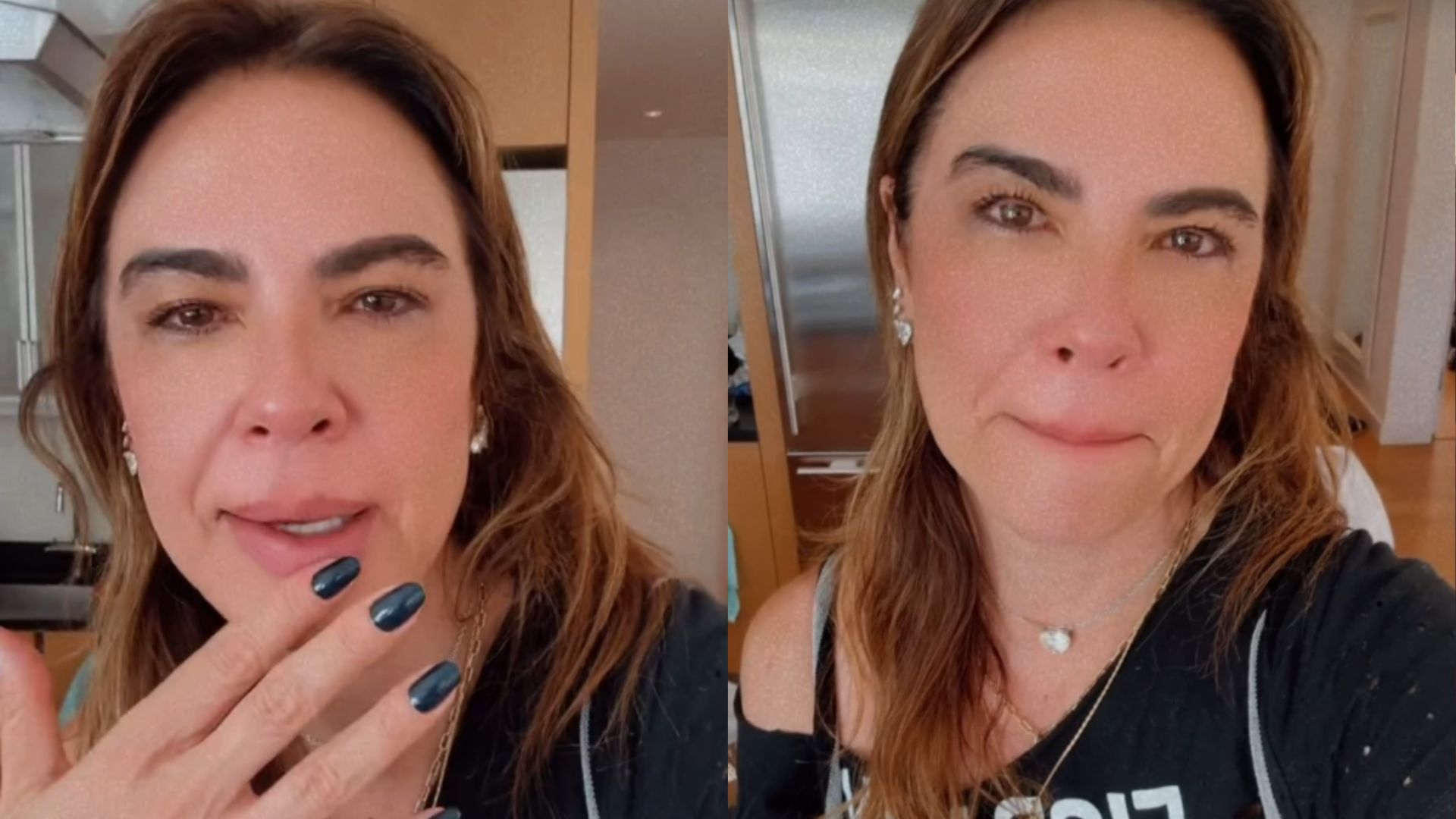 Luciana Gimenez se emociona ao esquiar pela 1ª vez desde acidente: “Aperto no coração”