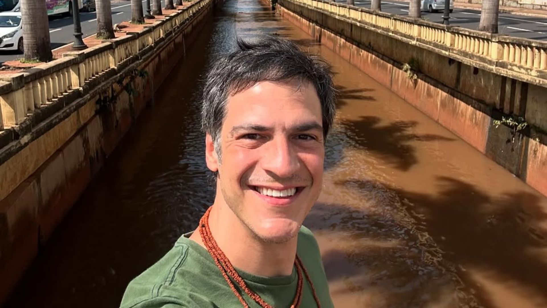 Mateus Solano abre o jogo sobre calvície: ‘Ridículo tentar esconder’