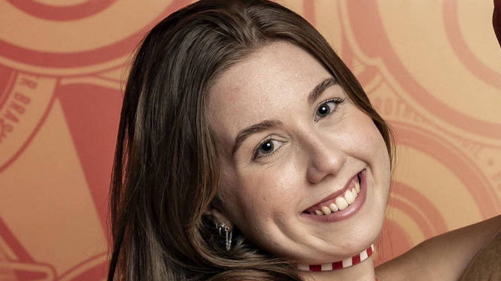 Médica alerta para reação alérgica de Raissa no BBB 25: ‘Uma das mais graves’