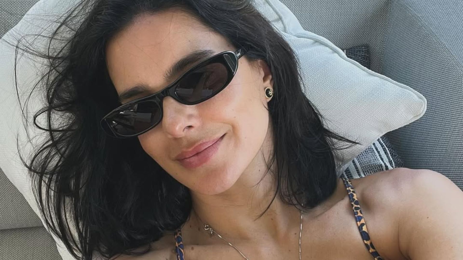 Vera Viel mostra cicatriz na perna e celebra recuperação após tumor