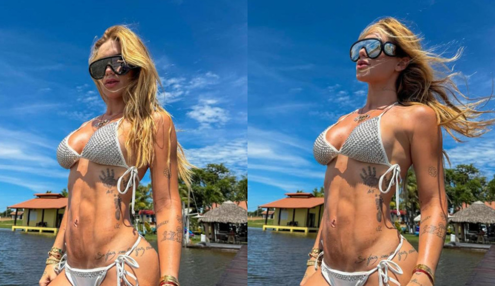 Médico diz que caso de Virginia Fonseca ilustra como é possível harmonizar saúde e estética