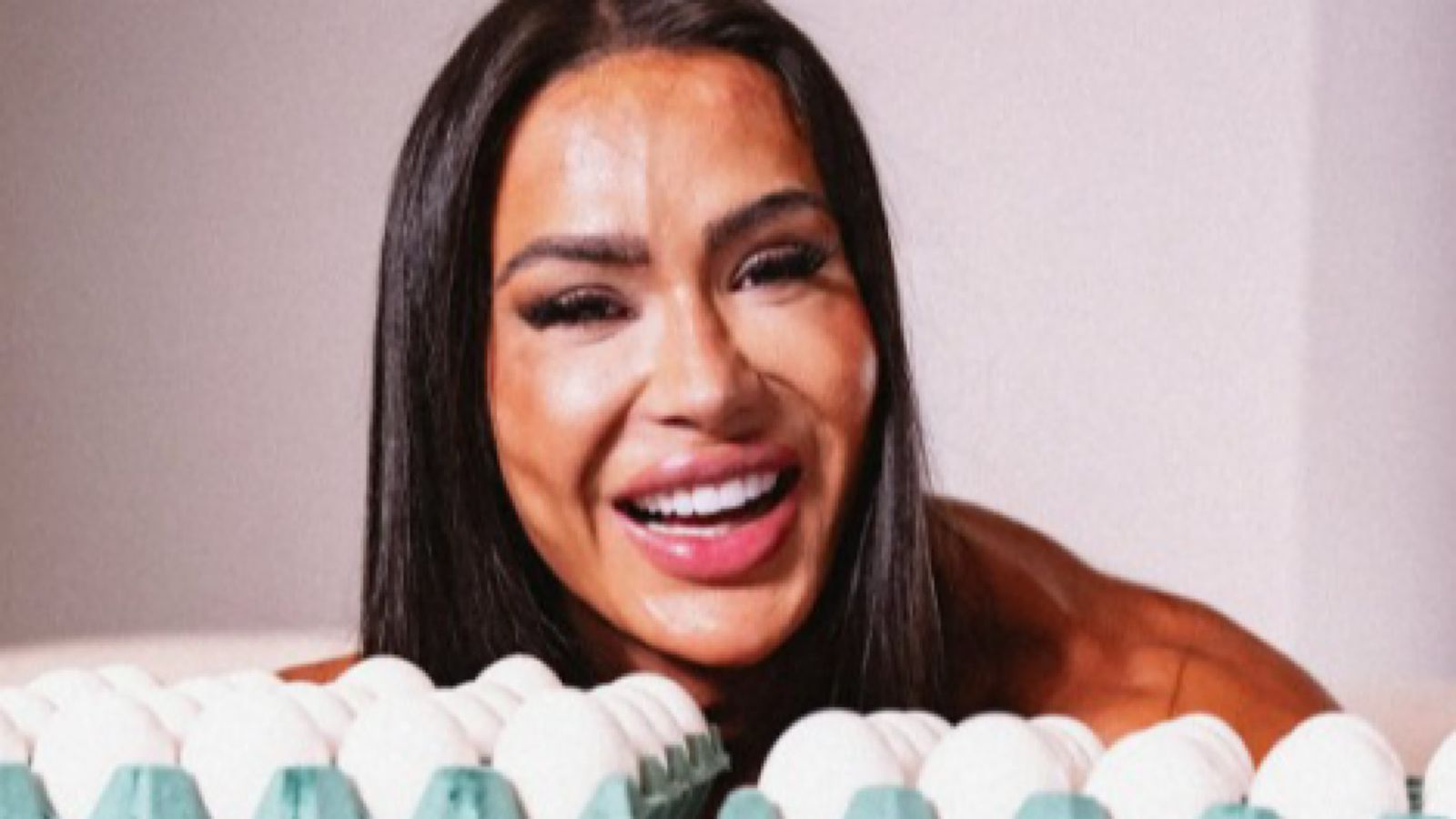 Médica alerta sobre emocional de Gracyanne ao encarar BBB sem dieta dos 40 ovos: ‘Impossível’