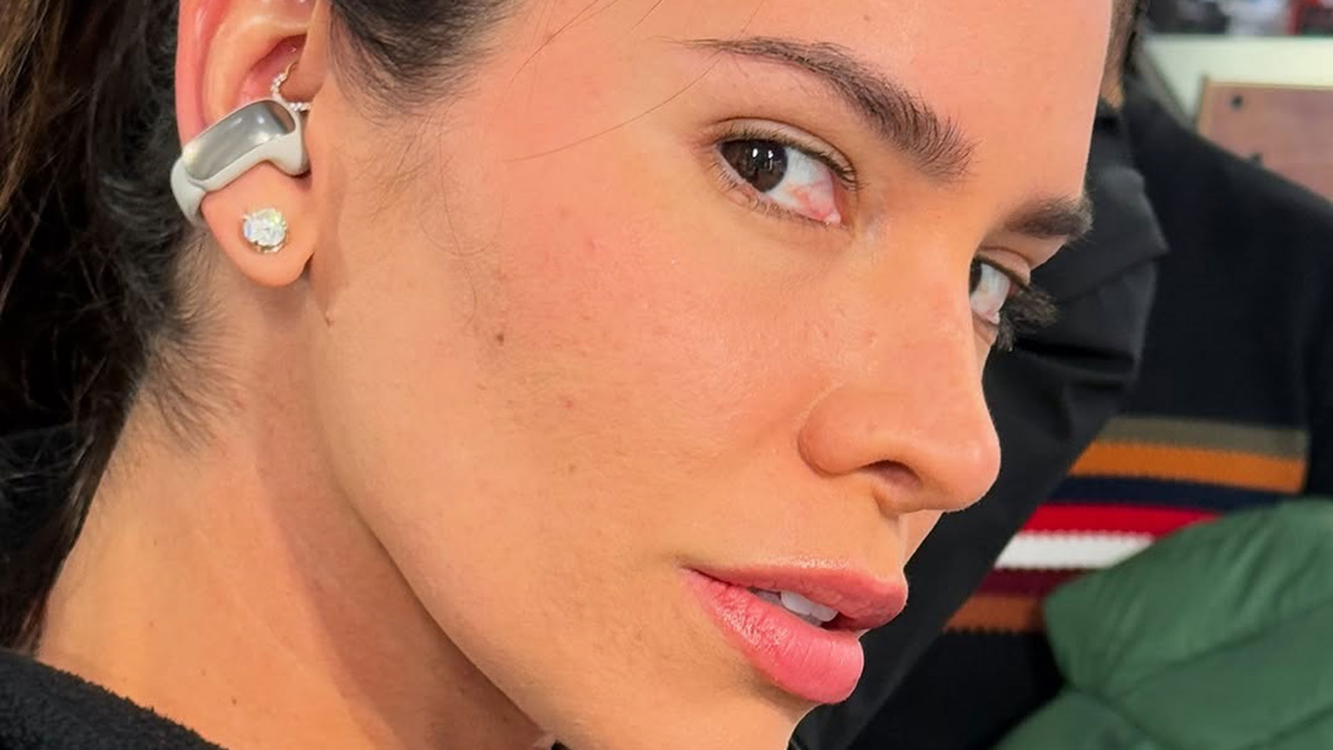 Adriana Sant’Anna descobre doença após ter crise alérgica