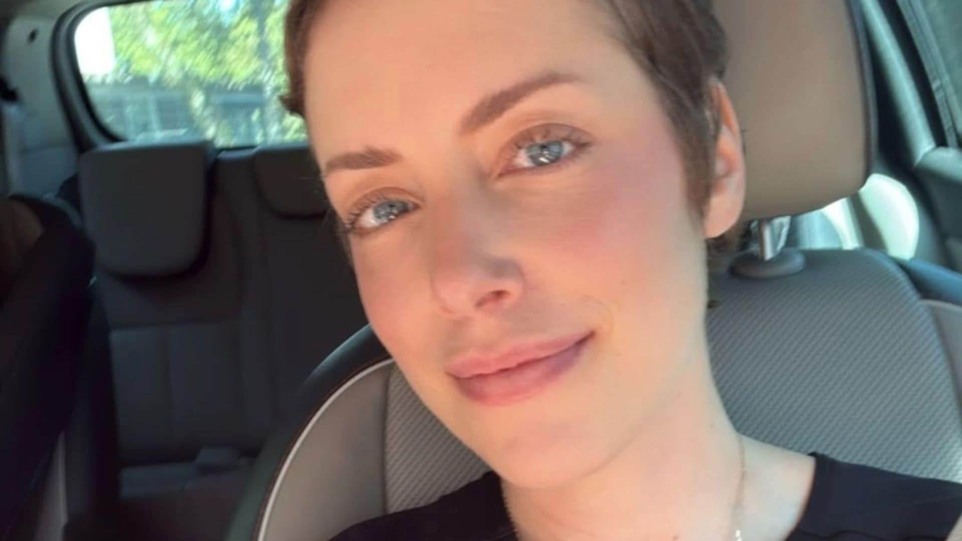 Fabiana Justus compartilha efeito colateral de medicação de manutenção