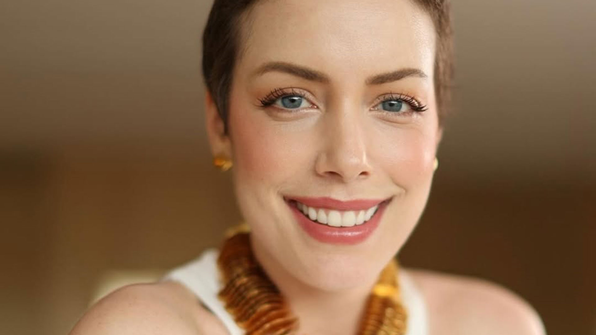 Fabiana Justus faz reflexão um ano após diagnóstico de leucemia