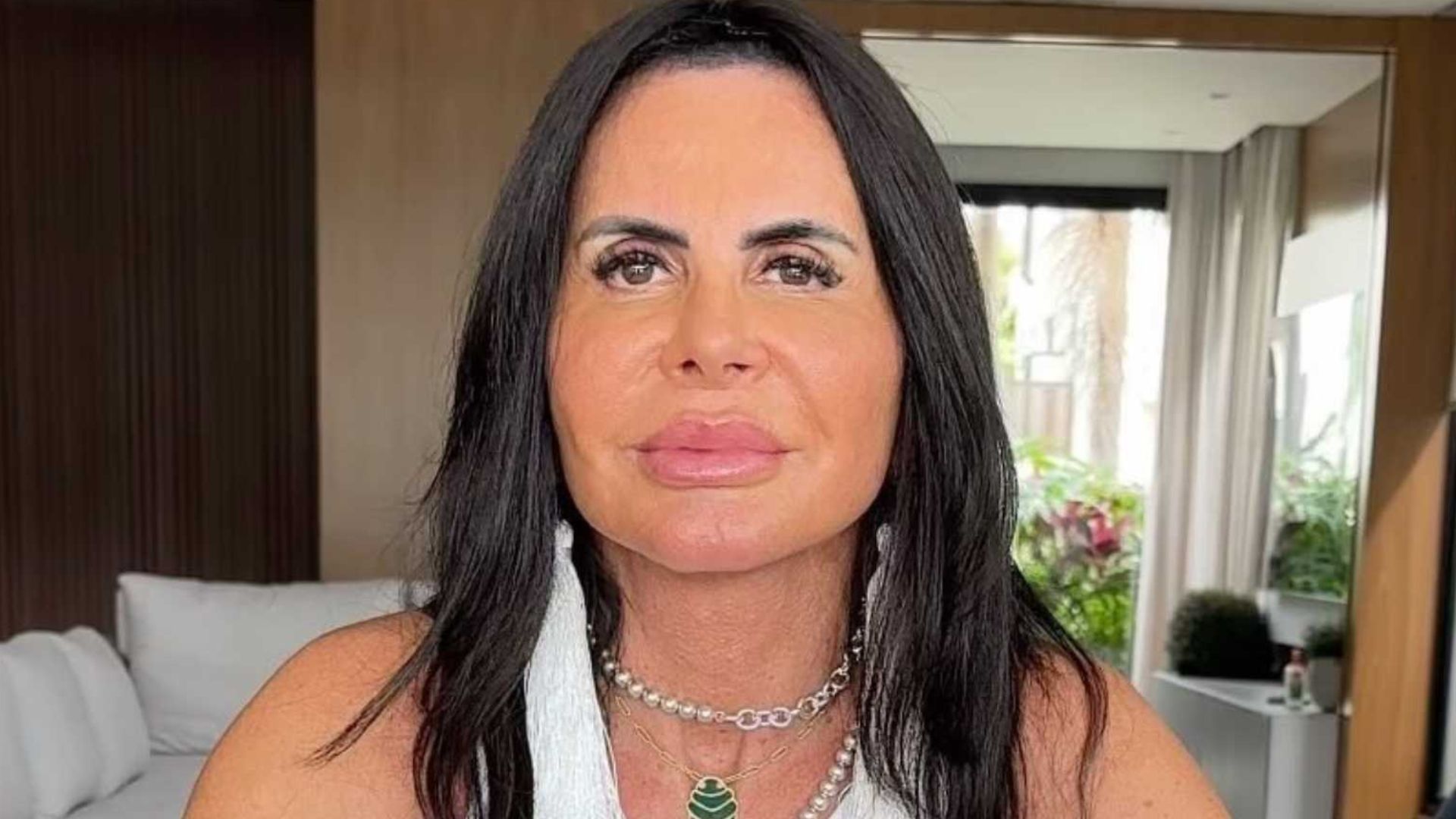 Gretchen passa por procedimento para retirar substância perigosa dos lábios