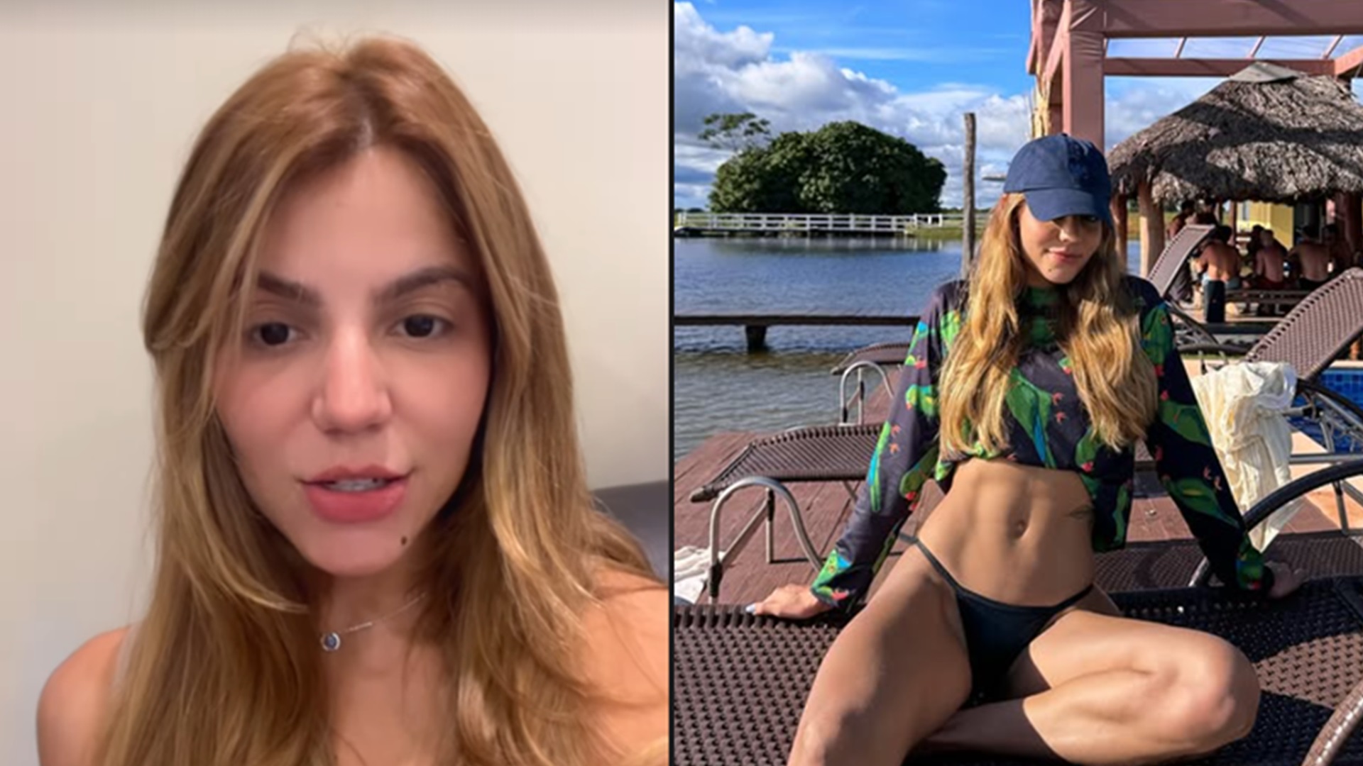 Hariany Almeida abre pontos de cirurgia após festa de João Guilherme: ‘Dei uma extrapolada’