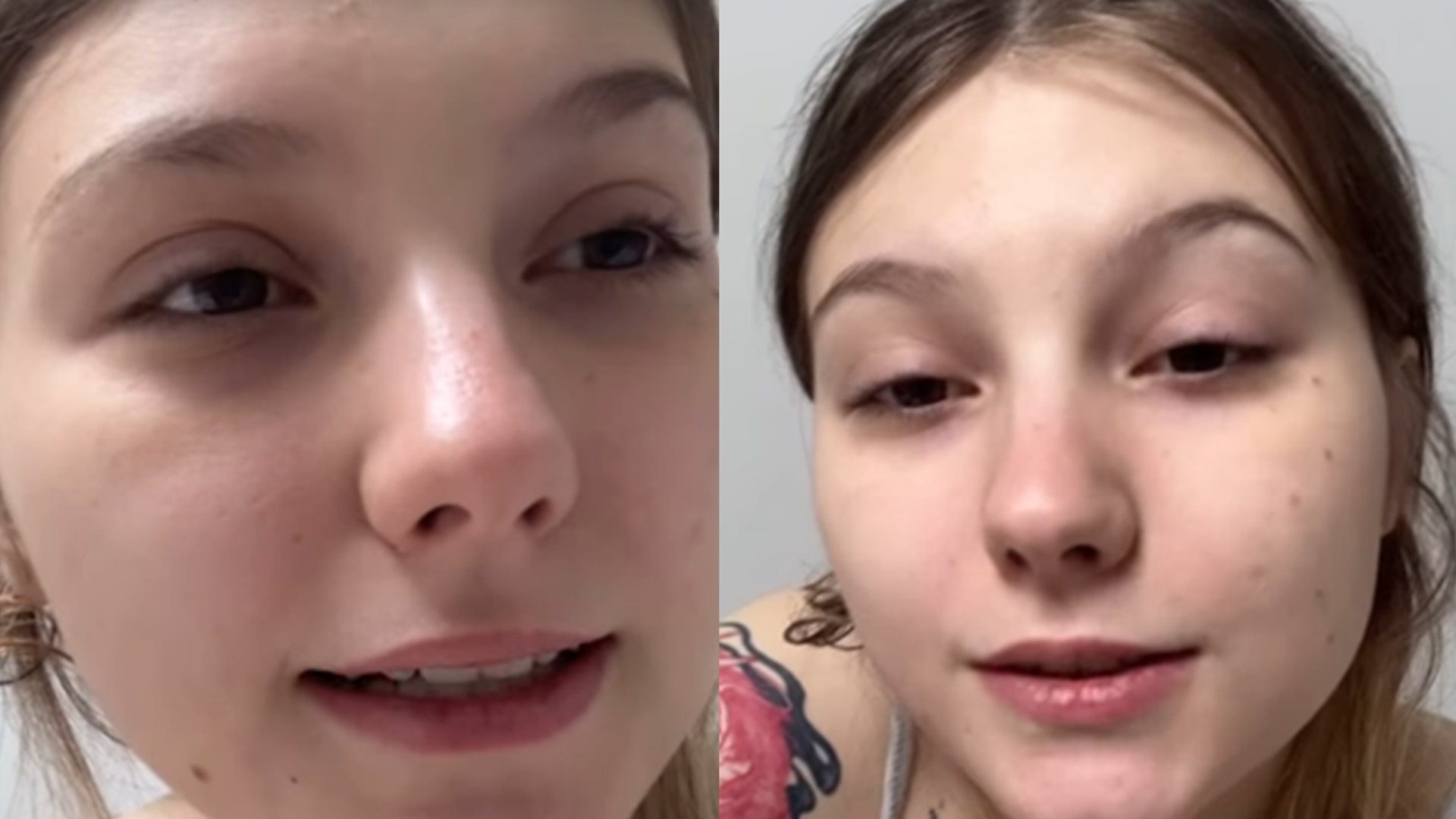 Às vésperas de cirurgia, Isabel Veloso diz que fará outro procedimento: ‘Vou aproveitar’