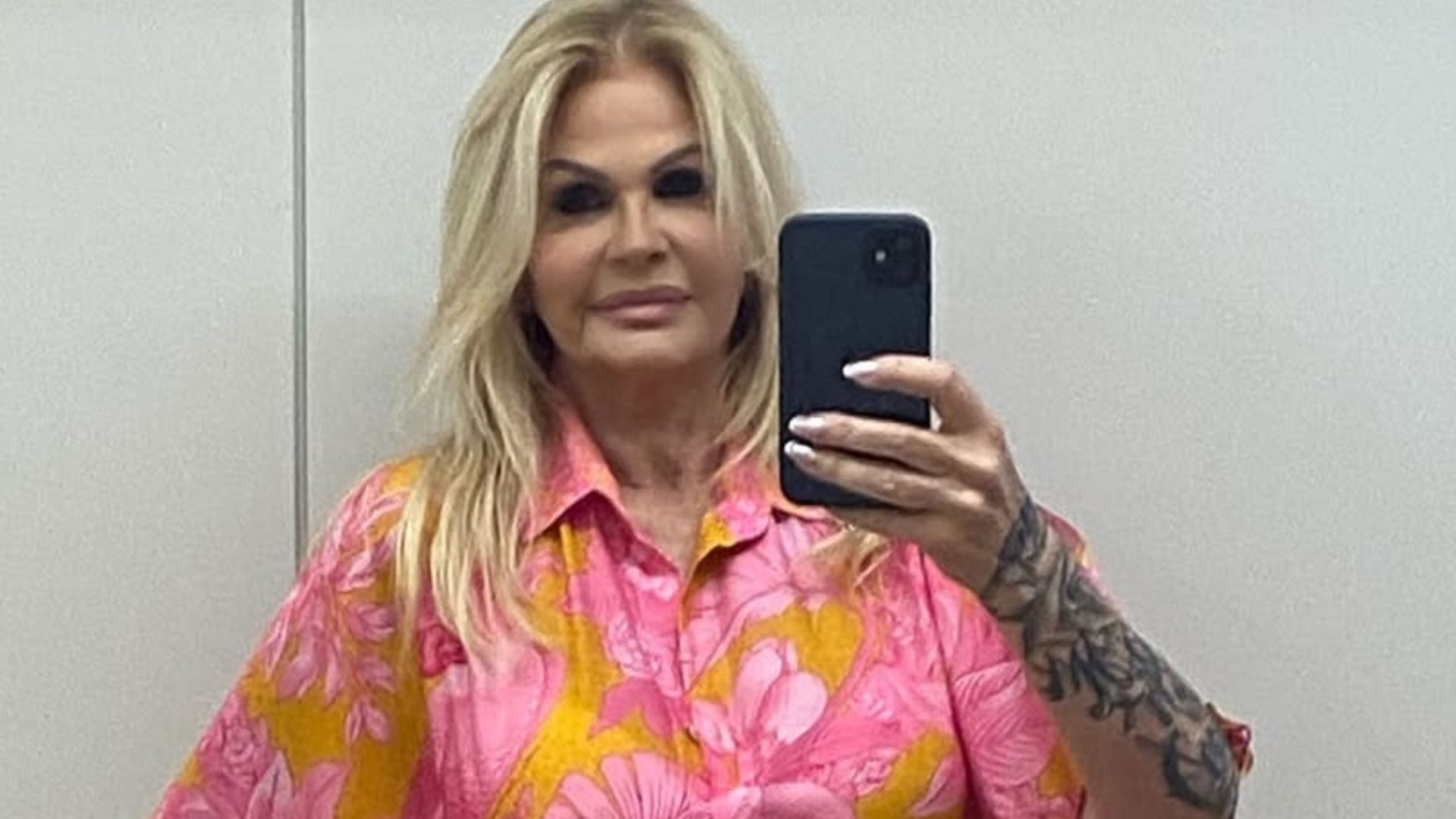 Monique Evans faz harmonização facial e mostra antes e depois