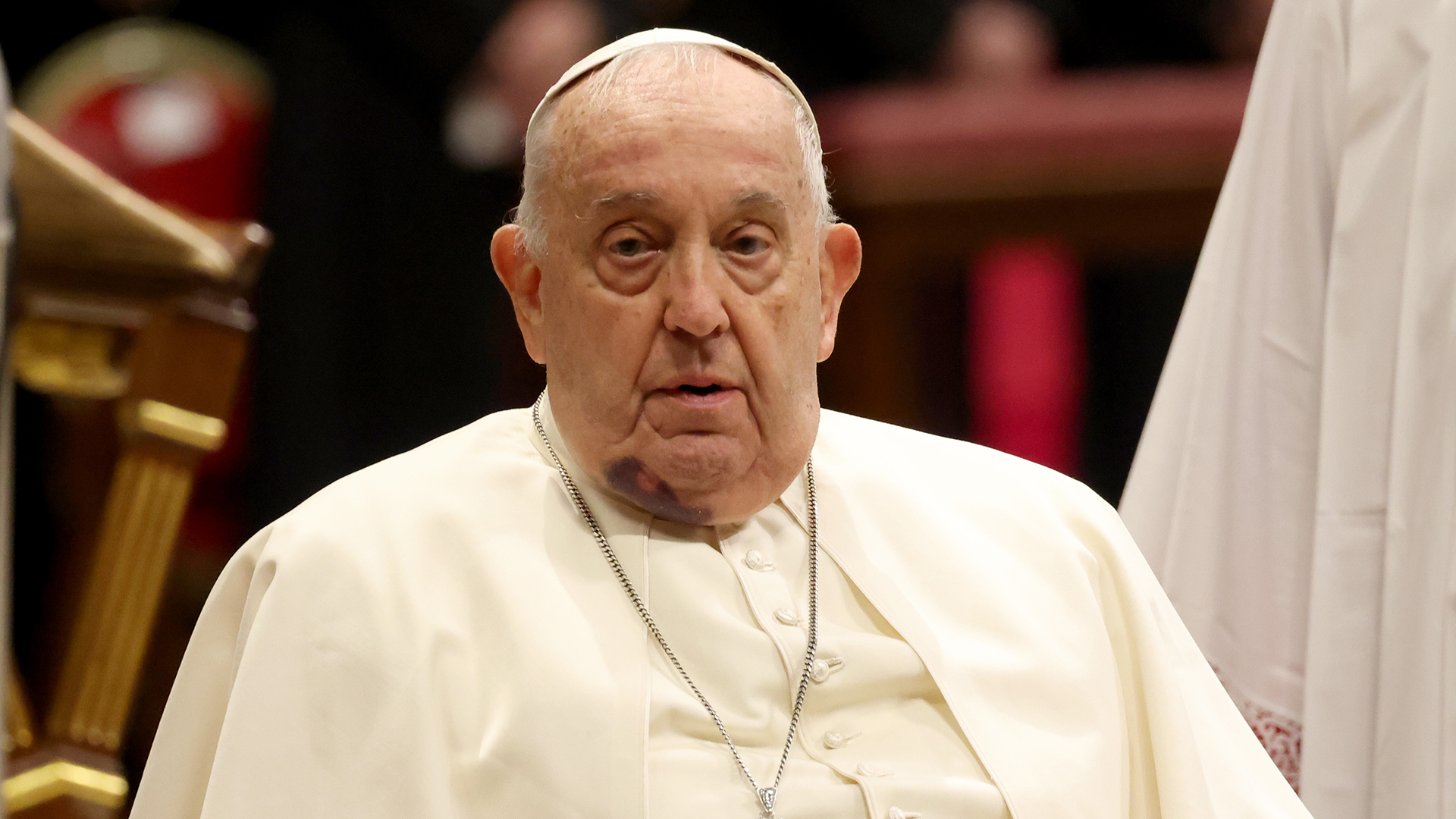 Papa Francisco sofre crise no hospital e seu estado é crítico