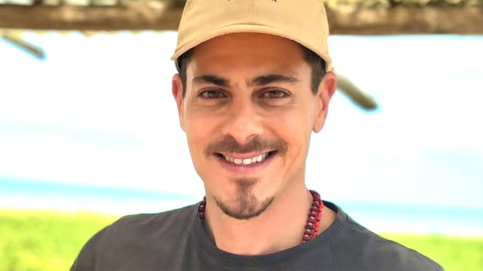 Sacha Bali faz harmonização facial e mostra fotos de antes e depois