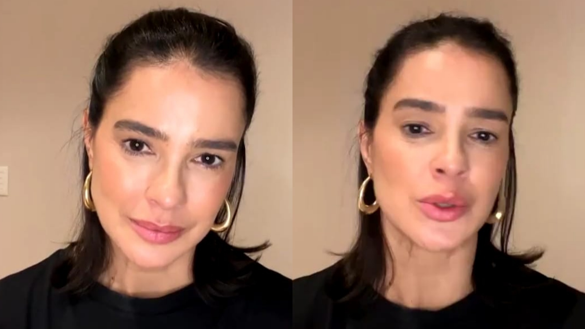 Vera Viel revela sequela após se curar de câncer: ‘Vou viver assim’