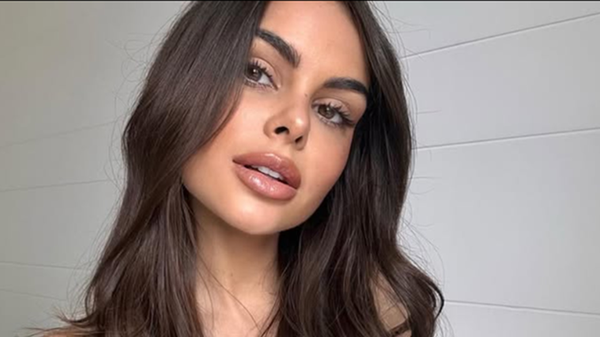 Médica de Amanda Kimberlly explica decisão de reverter harmonização facial: ‘Sempre buscou’