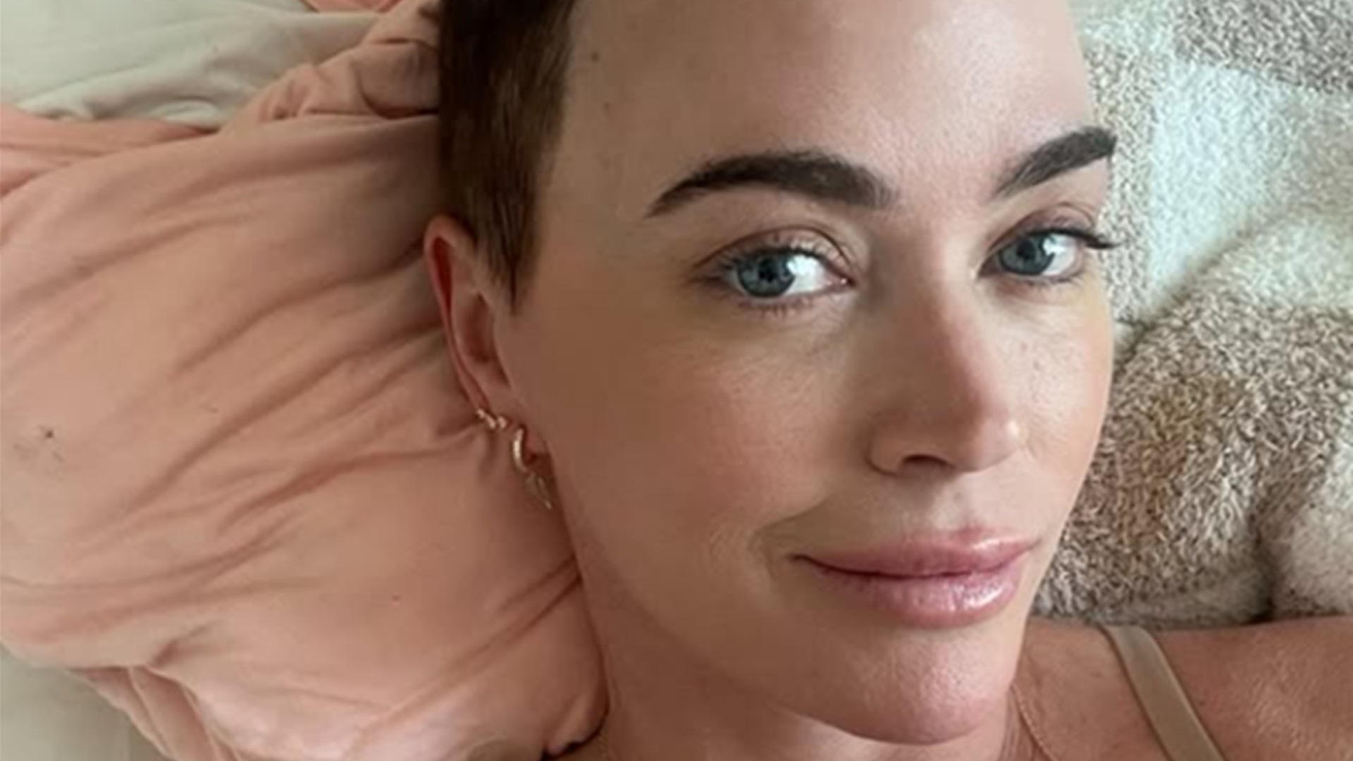 Apresentadora de 43 anos revela metástase após melanomas e cirurgia no cérebro