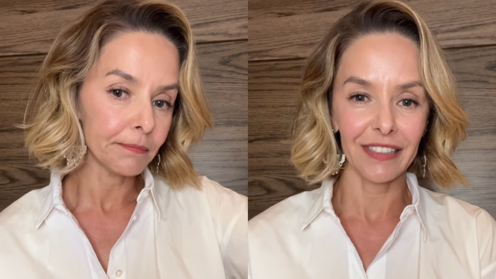 Bianca Rinaldi faz alerta após recordar descoberta de nódulo: ‘A cura existe’