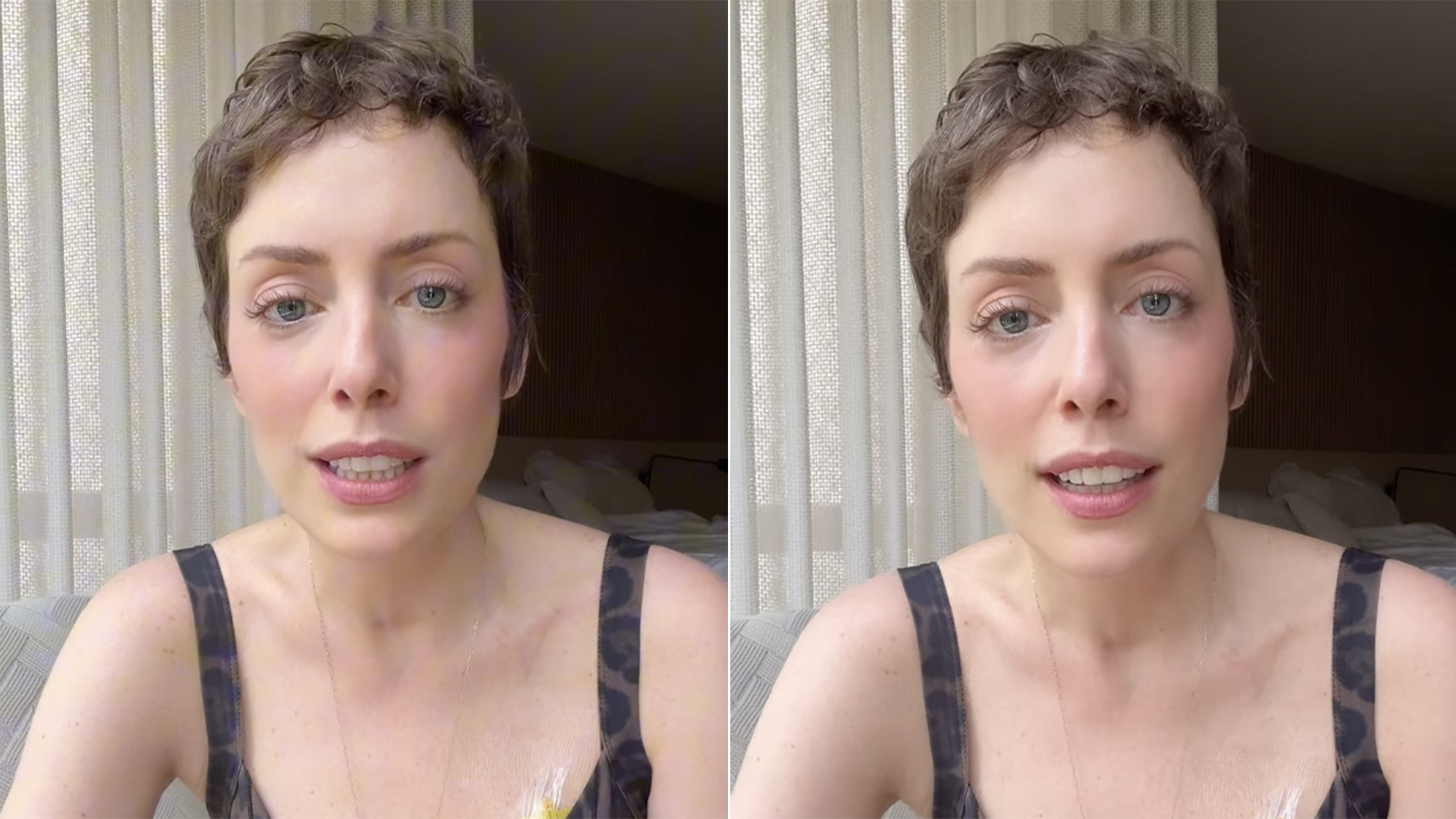 Fabiana Justus começa novo tratamento de saúde: ‘Doses altas’