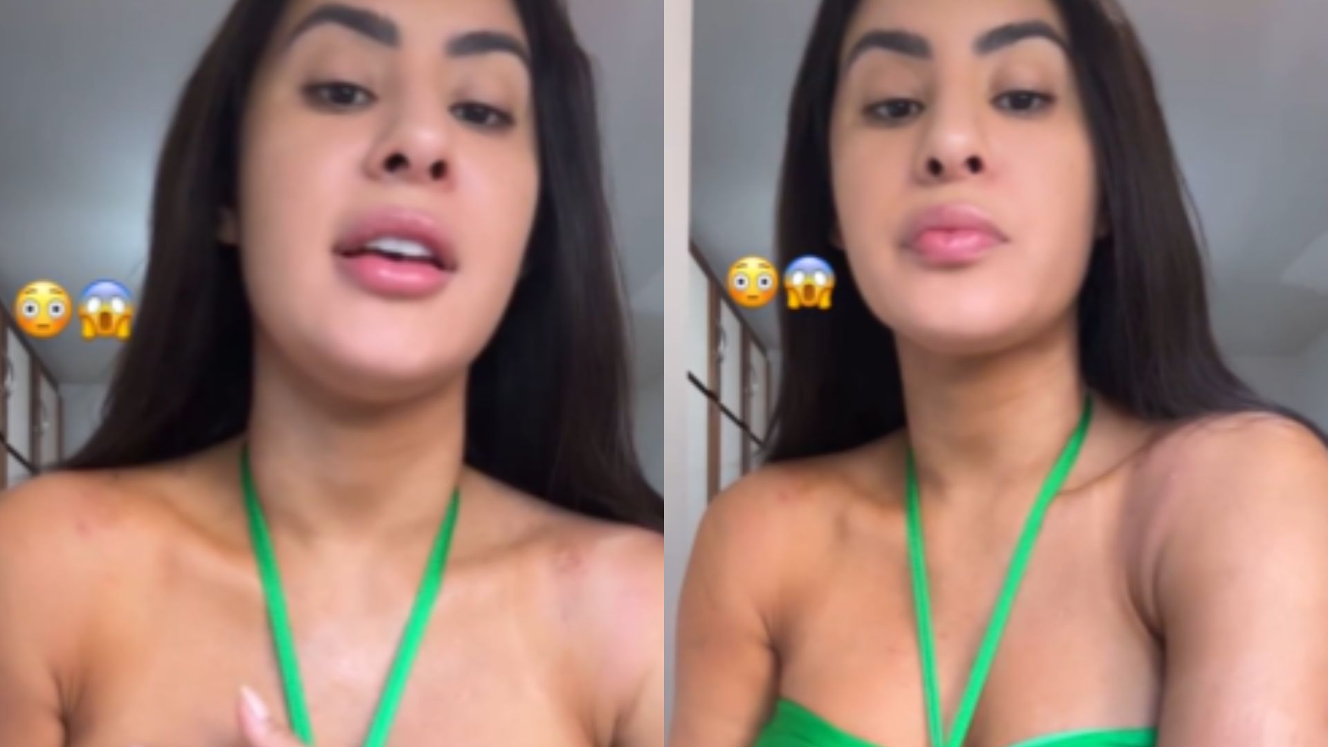 Isabelle Nogueira impressiona com machucados causados por fantasia de Carnaval