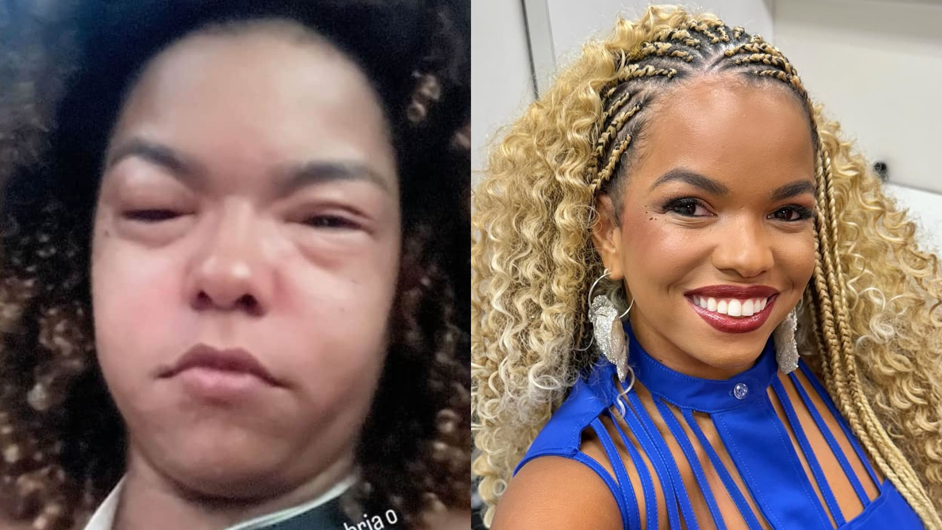 Alerta médico sobre diagnóstico de Jeniffer Nascimento: ‘Pode ser fatal’