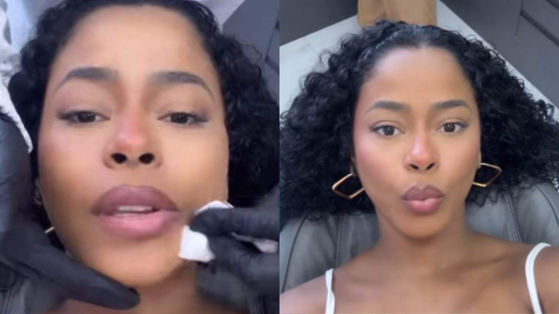 Lorena Maria aplica botox no rosto após dar à luz Rás: “Fiquei sem a gestação inteira”
