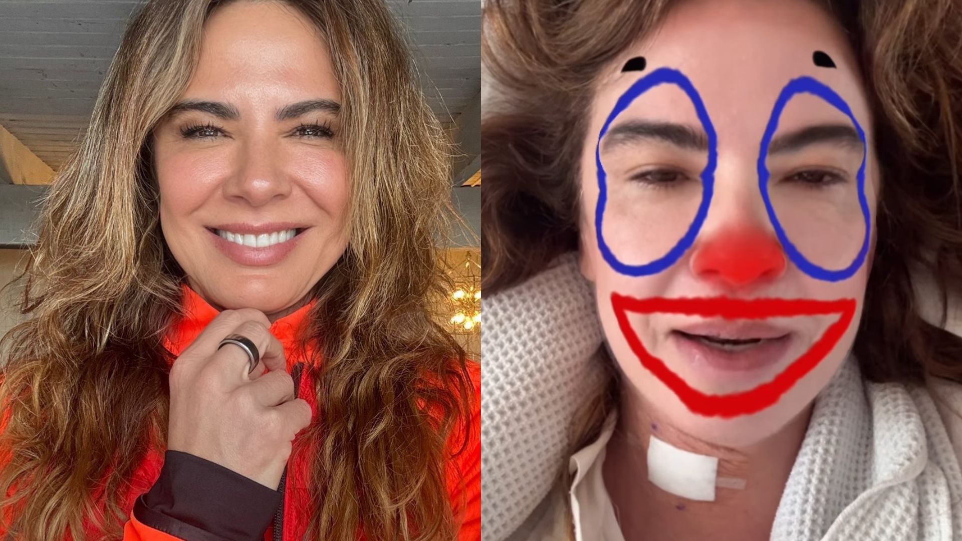 Luciana Gimenez detalha recuperação após cirurgia: ‘Situação ruim’