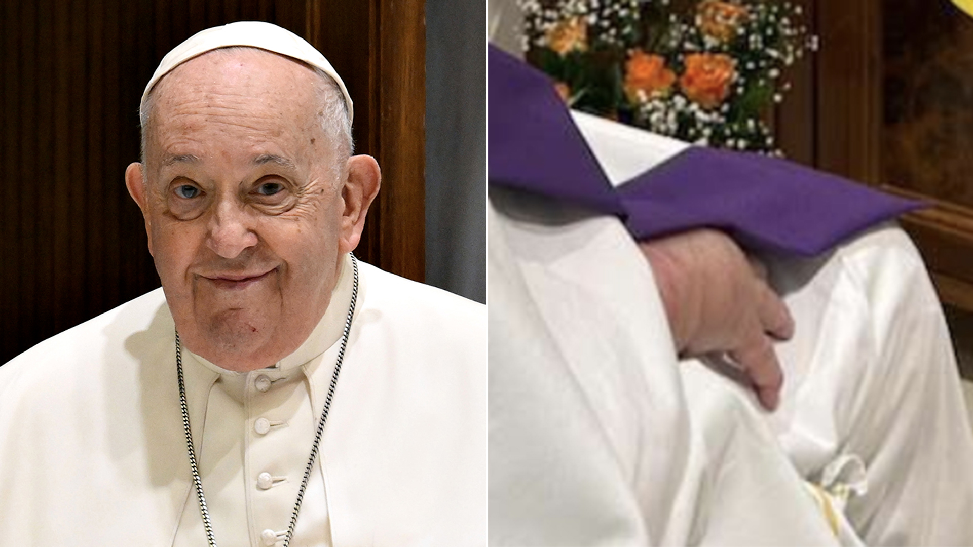 Por que a mão do Papa Francisco está inchada? Vaticano explica o motivo