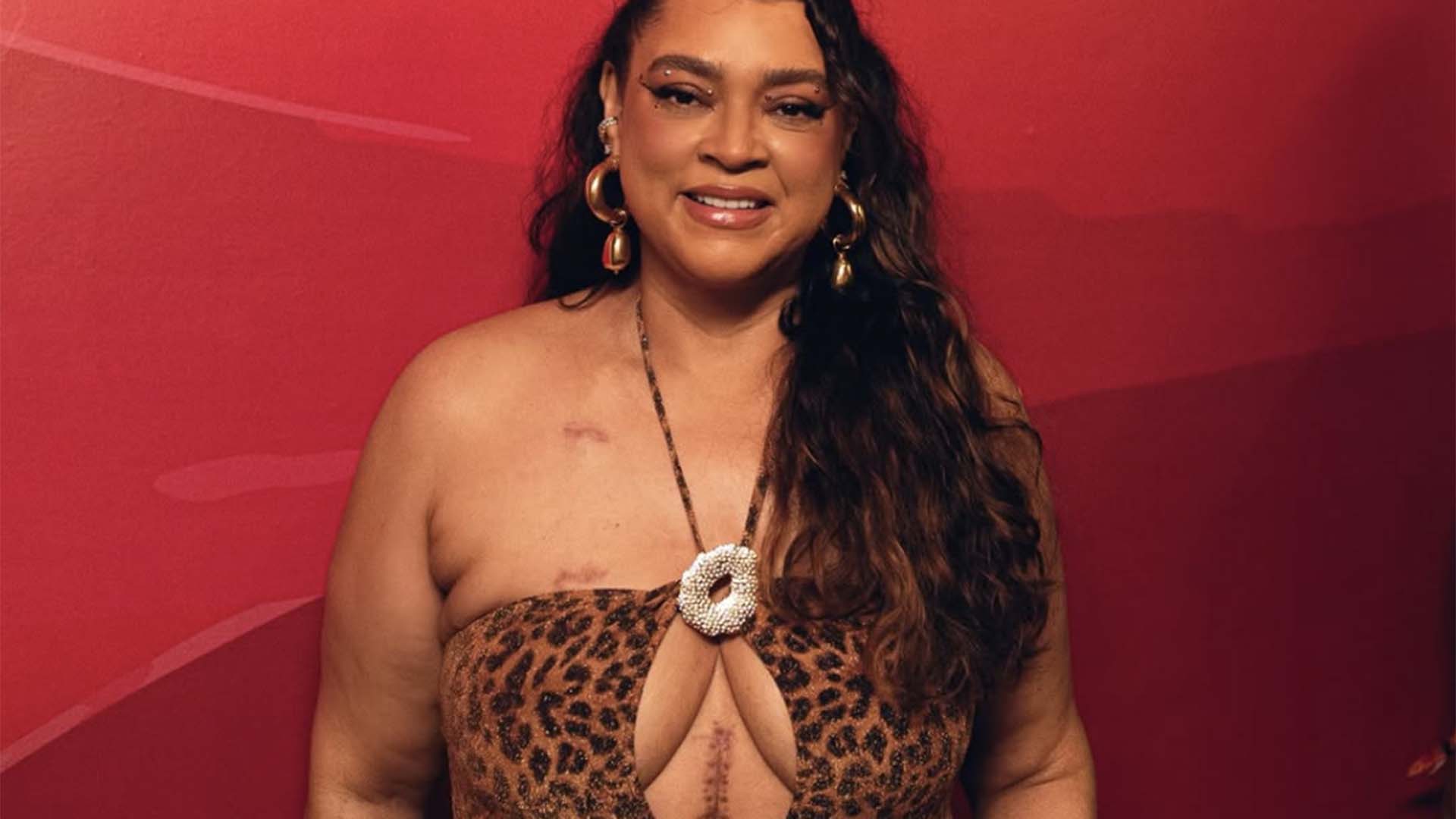 Preta Gil explica decisão de mostrar cicatriz no carnaval: ‘Botei pra jogo’