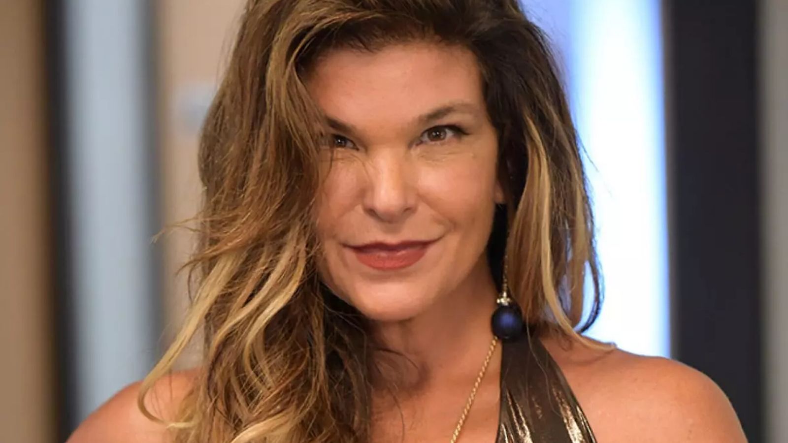 Médico explica tratamento da condição que afetou Cristiana Oliveira: ‘Fundamental para a boa evolução’