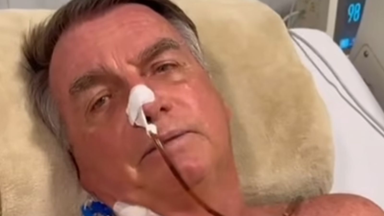 Médica explica cirurgia e quadro de Bolsonaro: ‘Exige atenção médica imediata’