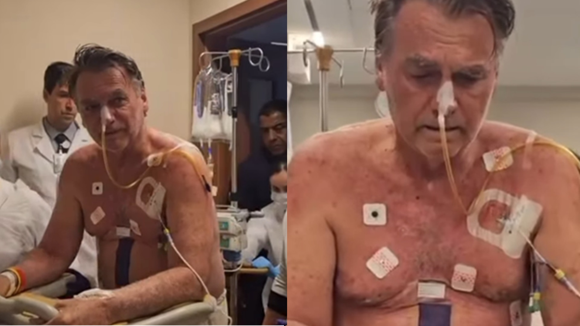 Jair Bolsonaro mostra sua recuperação após cirurgia de 12 horas: ‘Sem desistir’