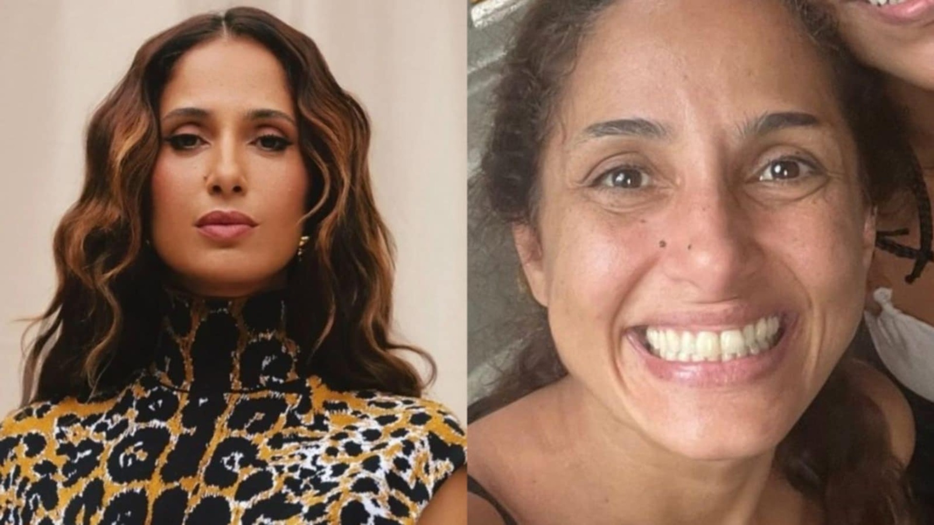 Camila Pitanga fala sobre não esconder suas rugas com procedimentos: ‘Escolha’