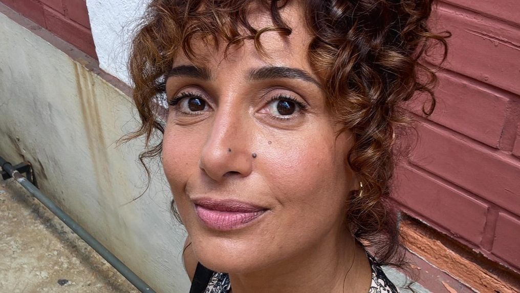 Médico aponta benefícios do procedimento estético de Camila Pitanga: ‘Forma global’