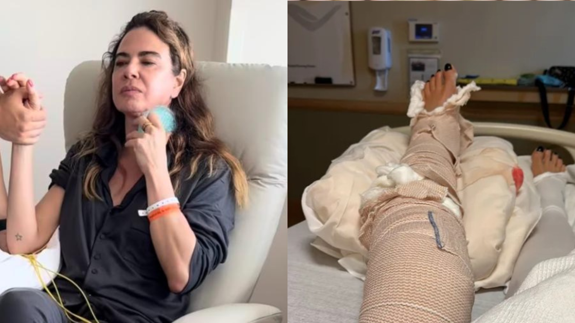 Médico alerta sobre dores de Luciana Gimenez antes de cirurgia às pressas: ‘Perda da força’
