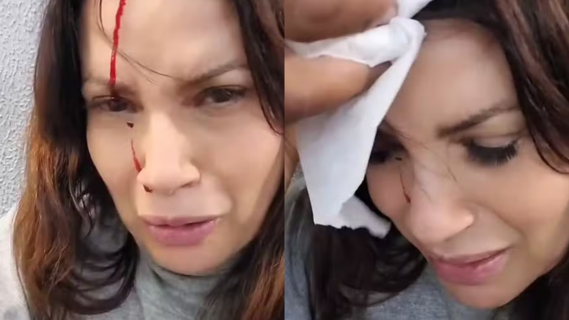 Médico faz alerta sobre riscos em acidente de ex-atriz da Globo: ‘Trauma’