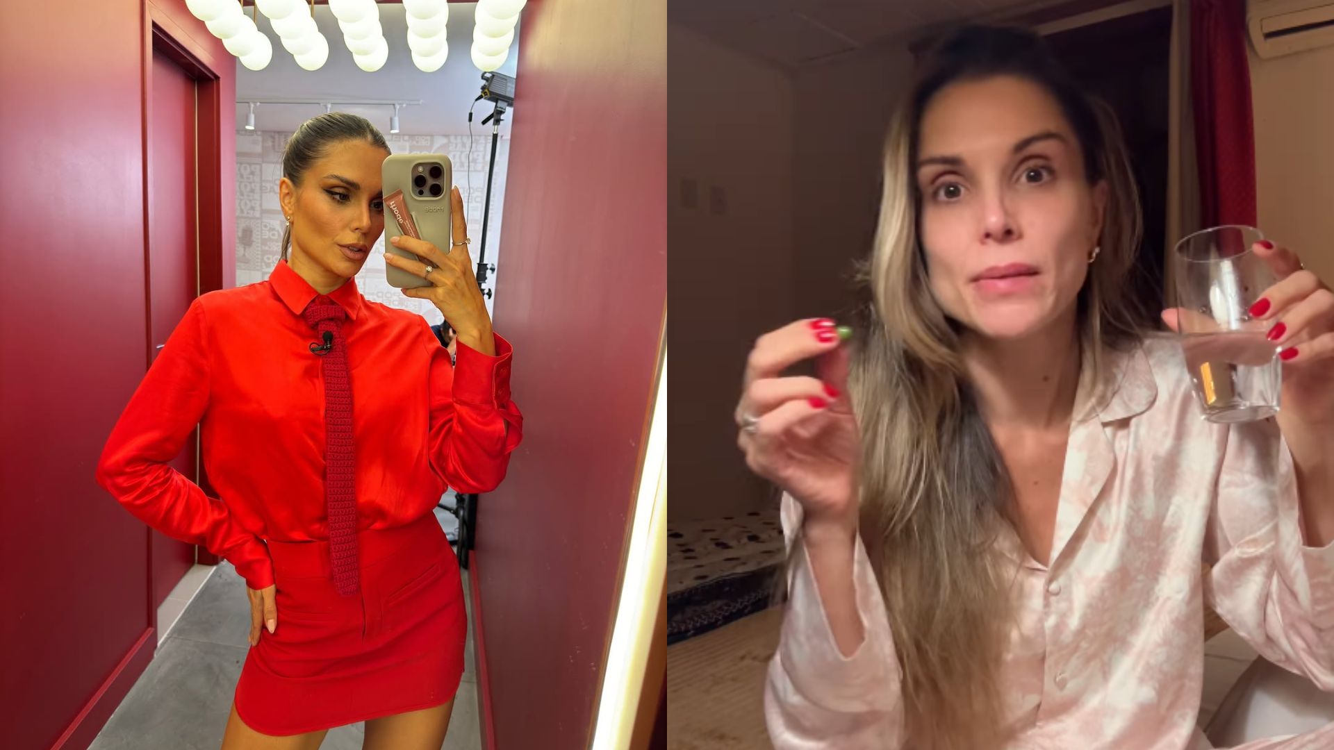 Flávia Viana tem reação alérgica antes do casamento: ‘Está doendo’