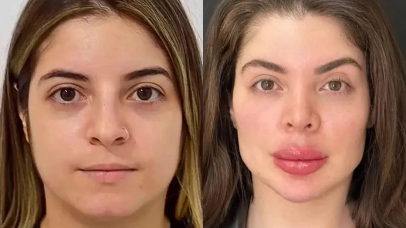 Especialista explica mudança no rosto de Gkay após perrengue na imigração dos EUA: ‘Algo sério’