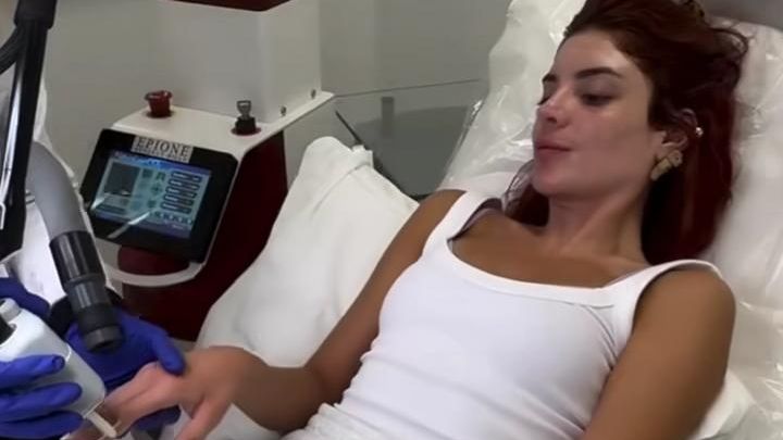 Médica detalha procedimento feito em Gkay: ‘Envolve conjunto de técnicas’